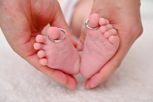 鄂尔多斯孕妇怎样预防妊娠纹